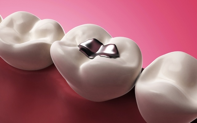 Animated smile with silver filling