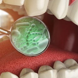 Digital image of bacteria in the mouth