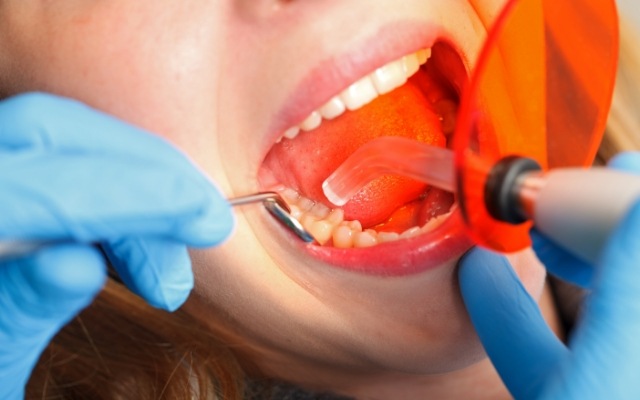 Dentistry patient receiving cosmetic dental bonding