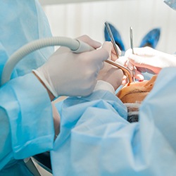 Dental implant surgery in Chaska