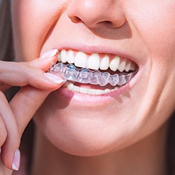 Woman inserting Invisalign onto her upper teeth