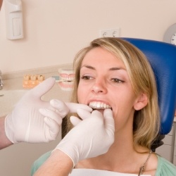 Dentist placing Invisalign tray