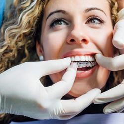 Woman meeting with dentist for routine checkup and fitting 