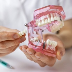 Dentist using model smile to explain emergency dentistry treatment
