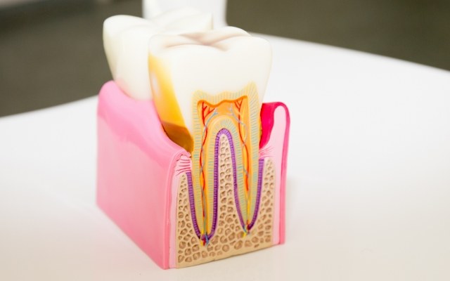 Model tooth used to explain root canal treatment