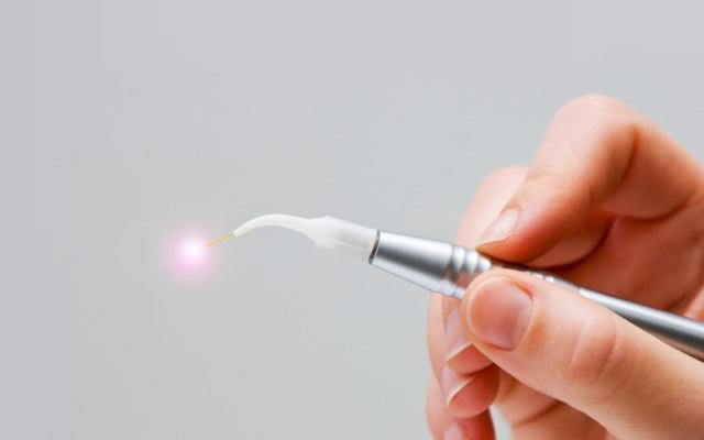 Hand holding a soft tissue laser dentistry hand tool