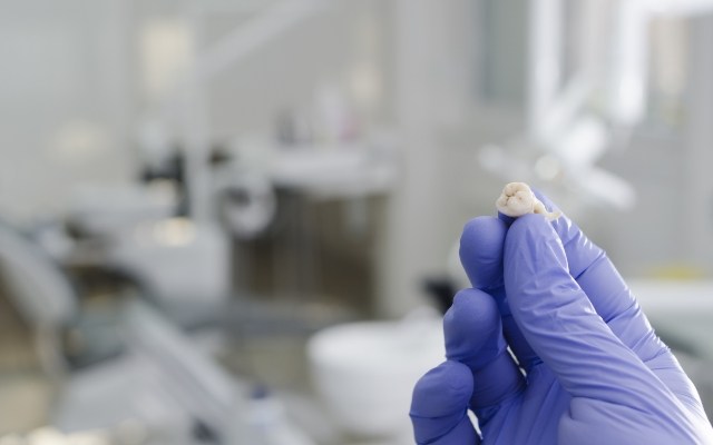 Hand holding an extracted tooth