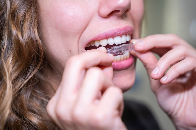 a woman wearing Invisalign