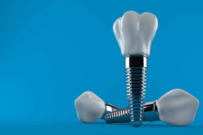 dental implants