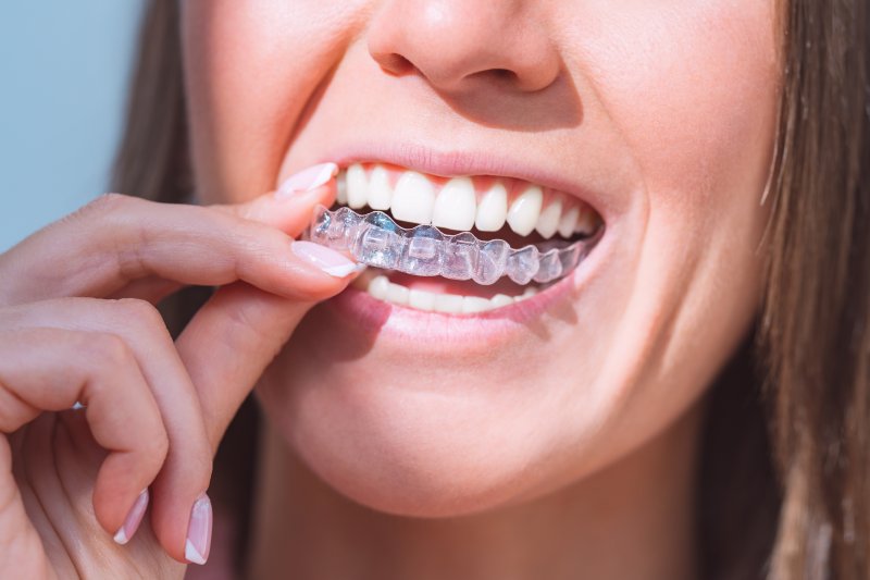 woman with an Invisalign aligner 